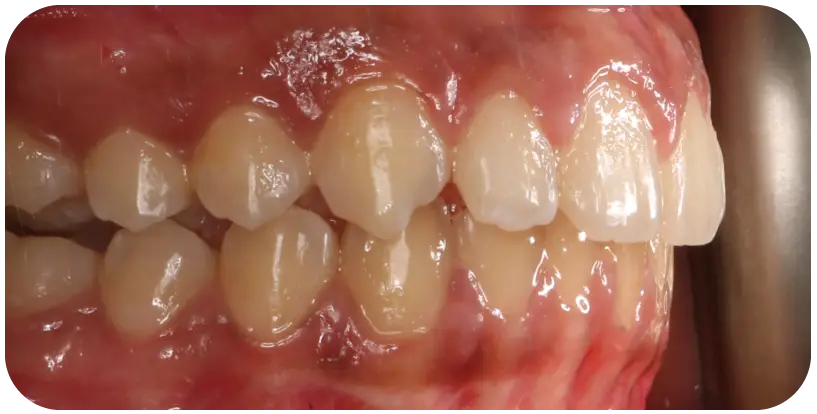 تحفيز-النمو2