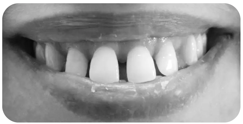 فراغات-وتقدم3